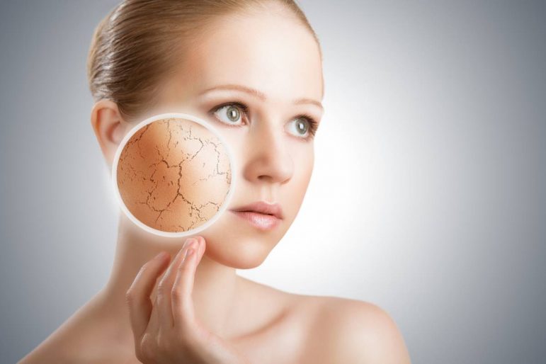 Eau calcaire et peau sèche : comment hydrater votre visage ?